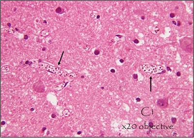 Frontiers | Neuroimmunology of Common Parasitic Infections in Africa